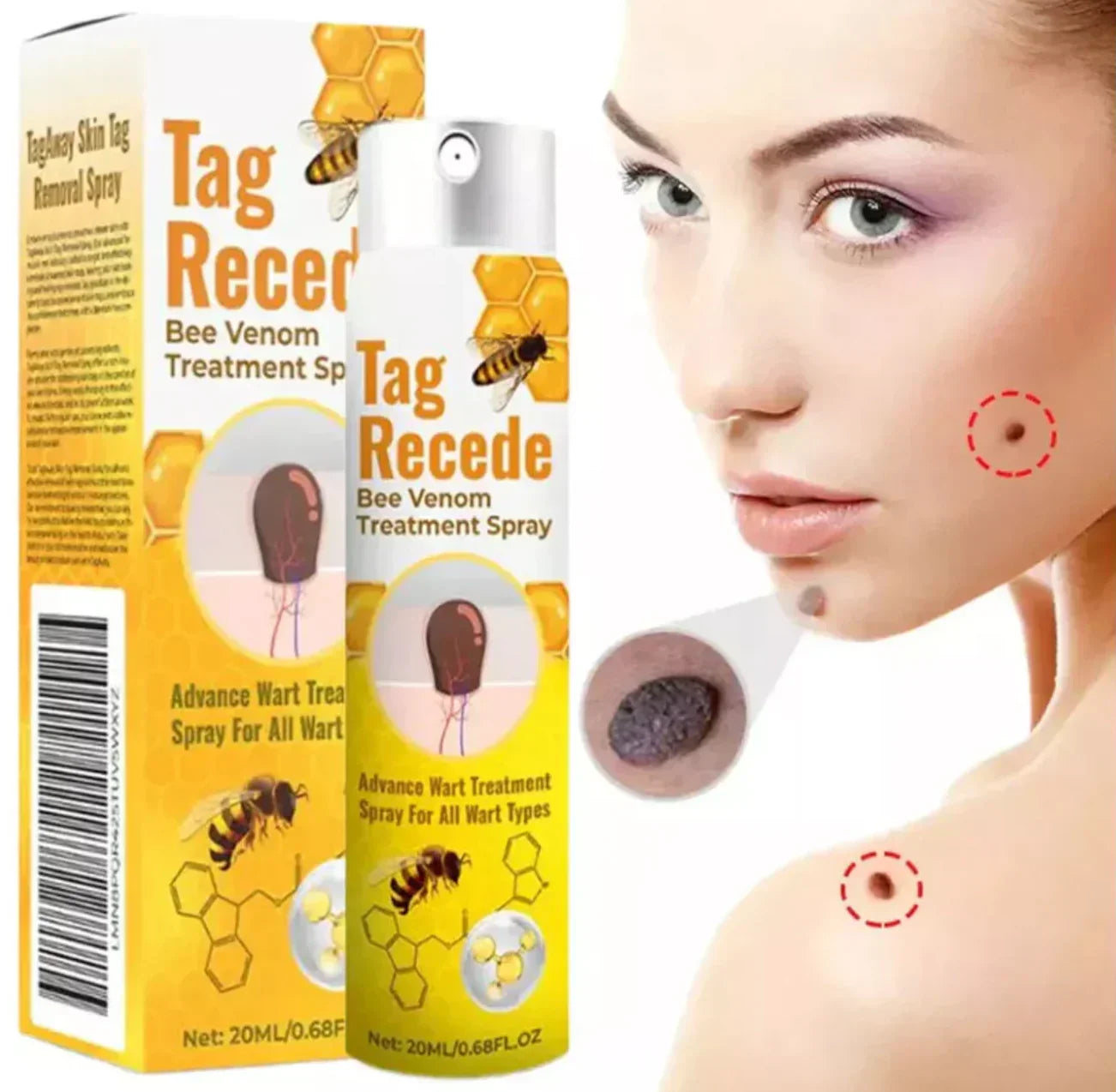 Tag Redece Elimina Verrugas y Manchas en días, sin dolor ni cicatrices 🔥👌🏻 REGALO Especial 2x1 🎁